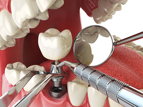 Best Pediatric Emergency Dentist in Baker, MT